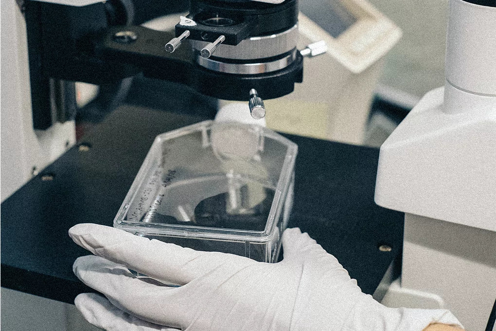 A rubber-gloved hand holds a petri dish full of bacteria under a microscope.